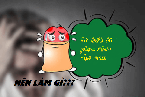 Bao quy đầu bị loét, sưng đỏ là bị sao?_Phòng khám Nam Khoa uy tín Hà Nội