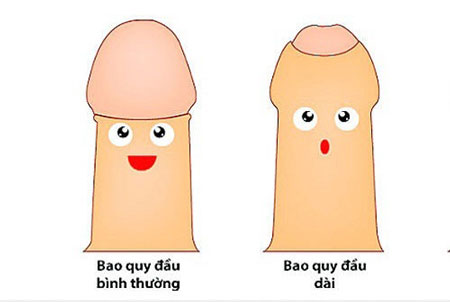 Dài bao quy đầu có ảnh hưởng gì không?