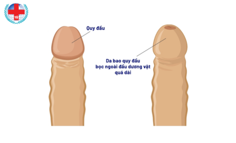 Thiết kế chưa có tên.png